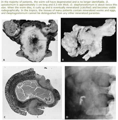 C:\Documents and Settings\Administrator\Desktop\Mineralised worms copy.jpg